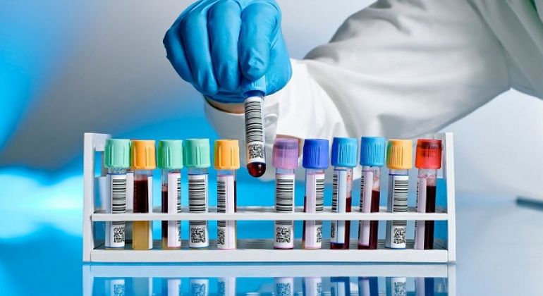 Assessoria Jurídica do Adufg emite parecer sobre a utilização de exames laboratoriais